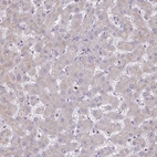 Immunohistochemical staining of human liver shows no positivity in hepatocytes as expected.