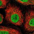 Immunofluorescent staining of human cell line HeLa shows localization to nucleoplasm & cytosol.
