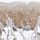 Immunohistochemical staining of human skin shows strong cytoplasmic granular positivity in squamous epithelial cells.