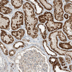 Immunohistochemical staining of human kidney shows strong cytoplasmic granular positivity in cells in tubules.