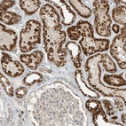 Immunohistochemical staining of human kidney shows strong cytoplasmic granular positivity in cells in tubules.