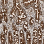 Immunohistochemical staining of human duodenum shows strong cytoplasmic granular positivity in glandular cells.