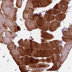 Immunohistochemical staining of human skeletal muscle shows strong cytoplasmic positivity in myocytes.