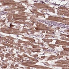 Immunohistochemical staining of human heart muscle shows strong cytoplasmic positivity in cardiomyocytes.