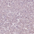 Immunohistochemical staining of human liver shows no positivity in hepatocytes as expected.