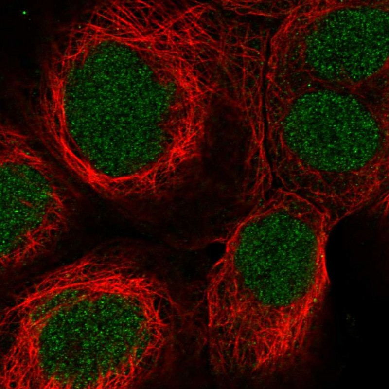 Anti-SYNGAP1 Antibody