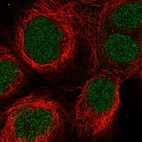 Anti-SYNGAP1 Antibody