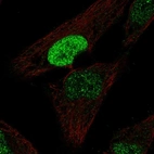 Anti-PDX1 Antibody