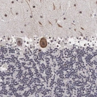 Immunohistochemical staining of human cerebellum shows strong nuclear positivity in Purkinje cells.