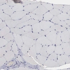 Immunohistochemical staining of human skeletal muscle shows no positivity in myocytes as expected.