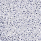 Immunohistochemical staining of human liver shows no positivity in hepatocytes as expected.