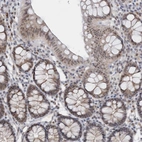 Immunohistochemical staining of human colon shows moderate nuclear positivity in glandular cells.