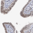 Immunohistochemical staining of human fallopian tube shows moderate nuclear positivity in glandular cells.