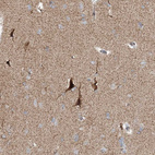 Immunohistochemical staining of human cerebral cortex shows strong cytoplasmic positivity in neurons.