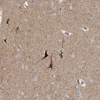 Immunohistochemical staining of human cerebral cortex shows strong cytoplasmic positivity in neurons.