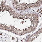 Immunohistochemical staining of human testis shows moderate cytoplasmic positivity in cells in seminiferous ducts.