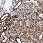 Immunohistochemical staining of human kidney shows strong cytoplasmic granular positivity in cells in tubules.