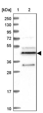 Lane 1: Marker [kDa] 250, 130, 95, 72, 55, 36, 28, 17, 10_br/_Lane 2: Human cell line RT-4
