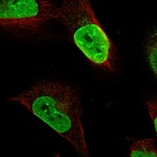 Immunofluorescent staining of human cell line U-251 MG shows localization to nucleoplasm & nuclear membrane.