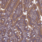 Immunohistochemical staining of human duodenum shows strong cytoplasmic positivity in glandular cells.