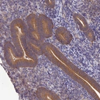 Immunohistochemical staining of human endometrium shows strong cytoplasmic positivity in glandular cells.