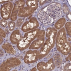 Immunohistochemical staining of human kidney shows strong cytoplasmic positivity in cells in tubules.