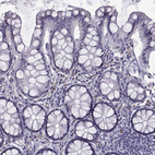Immunohistochemical staining of human colon shows no positivity in glandular cells as expected.
