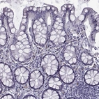 Immunohistochemical staining of human colon shows no positivity in glandular cells as expected.
