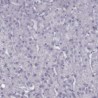Immunohistochemical staining of human liver shows no positivity in hepatocytes as expected.