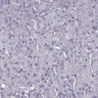 Immunohistochemical staining of human liver shows no positivity in hepatocytes as expected.