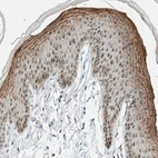 Immunohistochemical staining of human skin shows strong nuclear and cytoplasmic positivity in squamous epithelial cells.