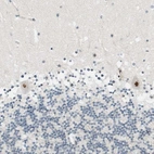 Immunohistochemical staining of human cerebellum shows strong nuclear positivity in Purkinje cells.
