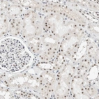 Immunohistochemical staining of human kidney shows strong nuclear positivity in cells in tubules.