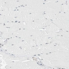 Immunohistochemical staining of human skeletal muscle shows no positivity in myocytes as expected.