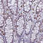 Immunohistochemical staining of human rectum shows strong cytoplasmic positivity in lymphoid cells.