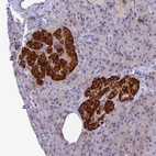 Immunohistochemical staining of human pancreas shows strong cytoplasmic positivity in islets of Langerhans.