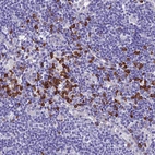Immunohistochemical staining of human lymph node shows strong cytoplasmic positivity in lymphoid cells.