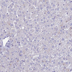 Immunohistochemical staining of human liver shows no positivity in hepatocytes as expected.