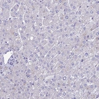 Immunohistochemical staining of human liver shows no positivity in hepatocytes as expected.