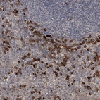 Immunohistochemical staining of human tonsil shows strong cytoplasmic positivity in non-germinal center cells.