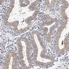 Immunohistochemical staining of human endometrium shows moderate cytoplasmic positivity in glandular cells.