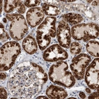 Immunohistochemical staining of human kidney shows strong cytoplasmic positivity in cells in tubules.