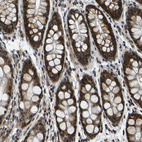Immunohistochemical staining of human rectum shows strong nuclear positivity in glandular cells.