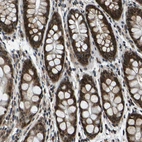 Immunohistochemical staining of human rectum shows strong nuclear positivity in glandular cells.