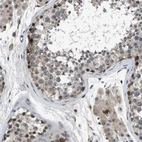 Immunohistochemical staining of human testis shows strong nuclear positivity in a subset of cells in seminiferous ducts.