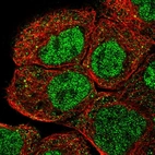 Immunofluorescent staining of human cell line A-431 shows localization to nucleoplasm & cytosol.