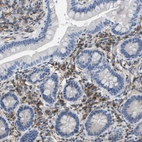 Immunohistochemical staining of human small intestine shows strong cytoplasmic positivity in lymphoid cells.
