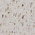 Immunohistochemical staining of human cerebral cortex shows strong cytoplasmic positivity in neurons.