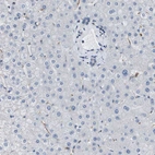 Immunohistochemical staining of human liver shows no positivity in hepatocytes as expected.