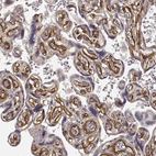 Immunohistochemical staining of human placenta shows strong cytoplasmic positivity in endothelial cells.